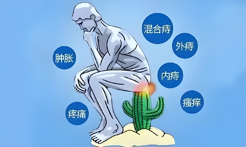 治疗与护理肛肠健康