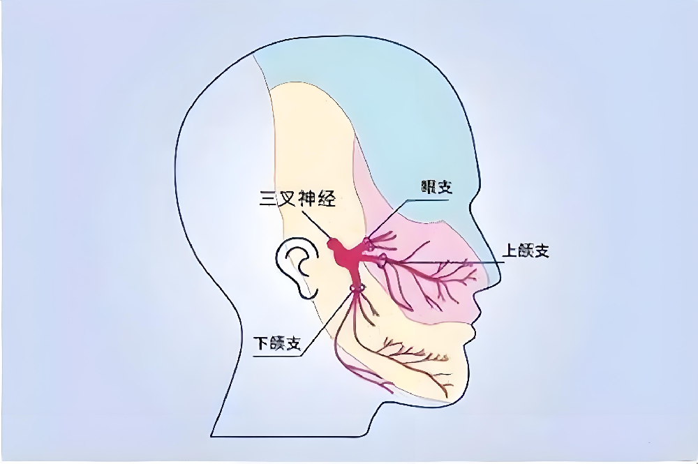 预防三叉神经痛的方法有哪些呢？