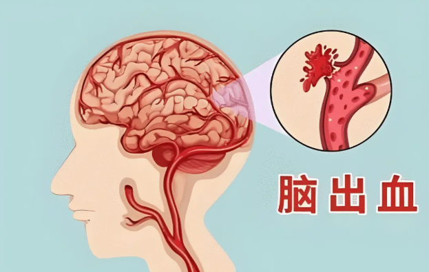 a3504a5ef3f8e381bfc6a176a8c2ca4.png