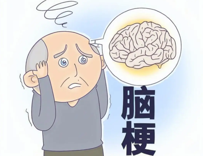 如何每天5分钟穴位按摩，疏通经络防脑梗？