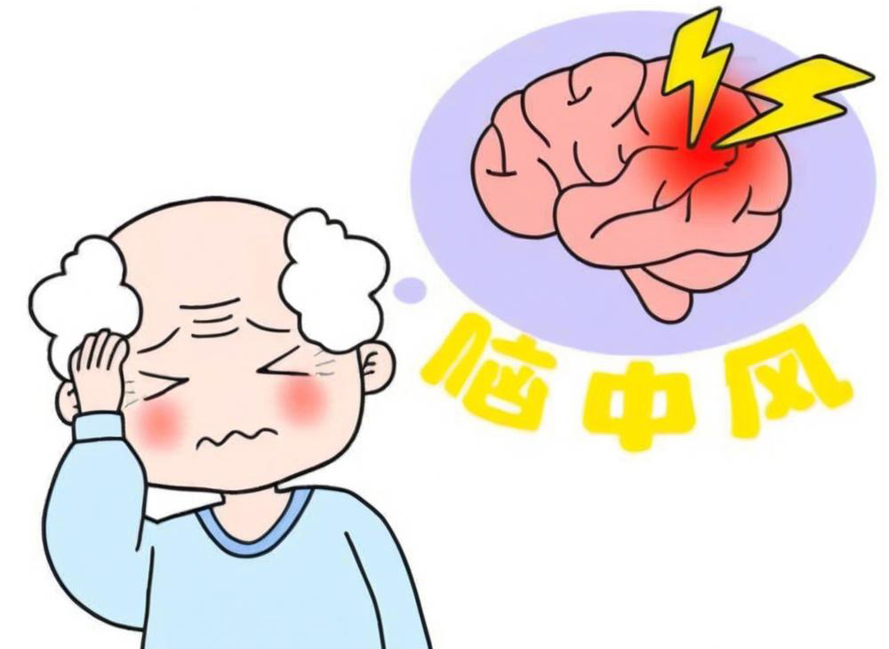 好端端的怎么突然就中风了？中医说大多与这四点有关，需重视！