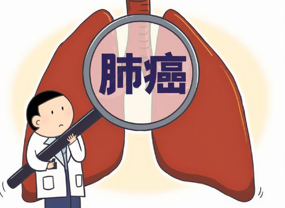 如何预防肺癌复发？南京太乙堂为你支招，早知道、早受益！