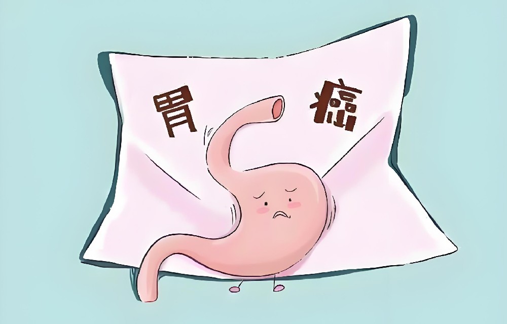 胃癌偏爱这四类人！中医：早防早查很重要！