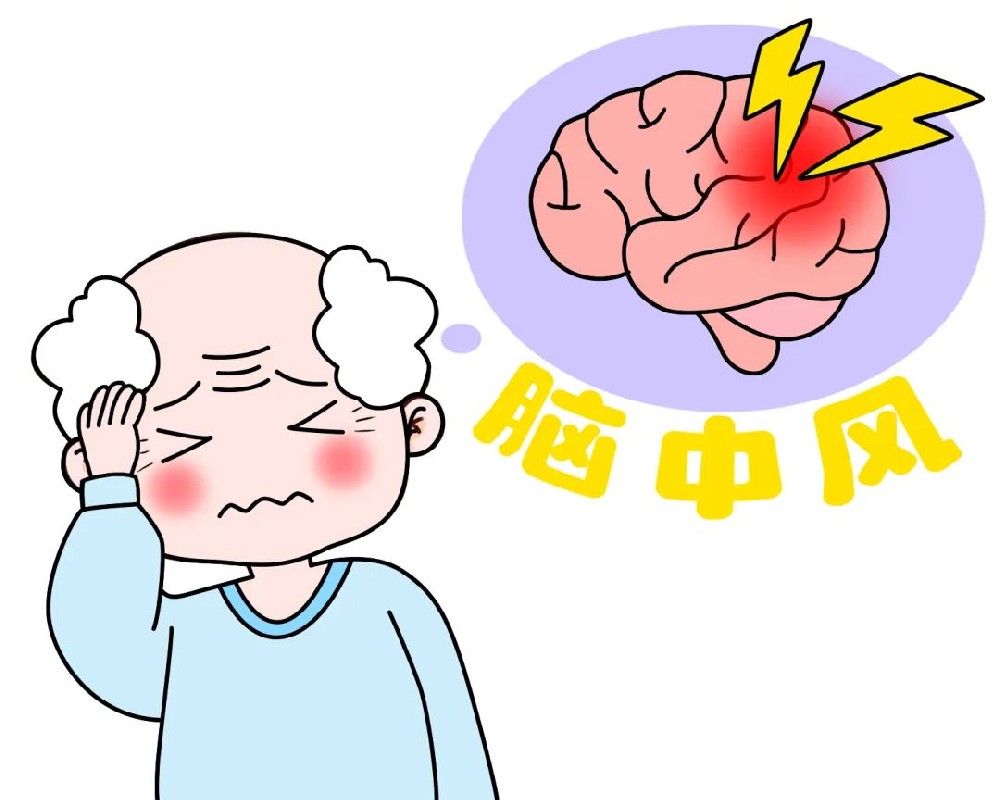 别让习惯伤了脑血管！不良生活习惯是脑中风诱因