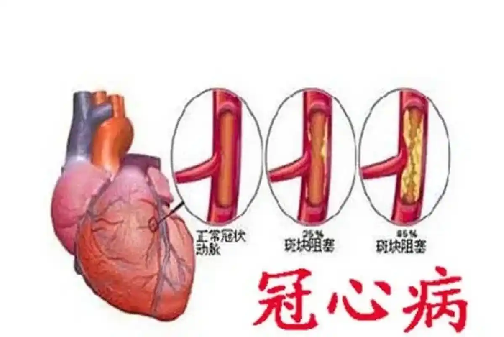 藏在